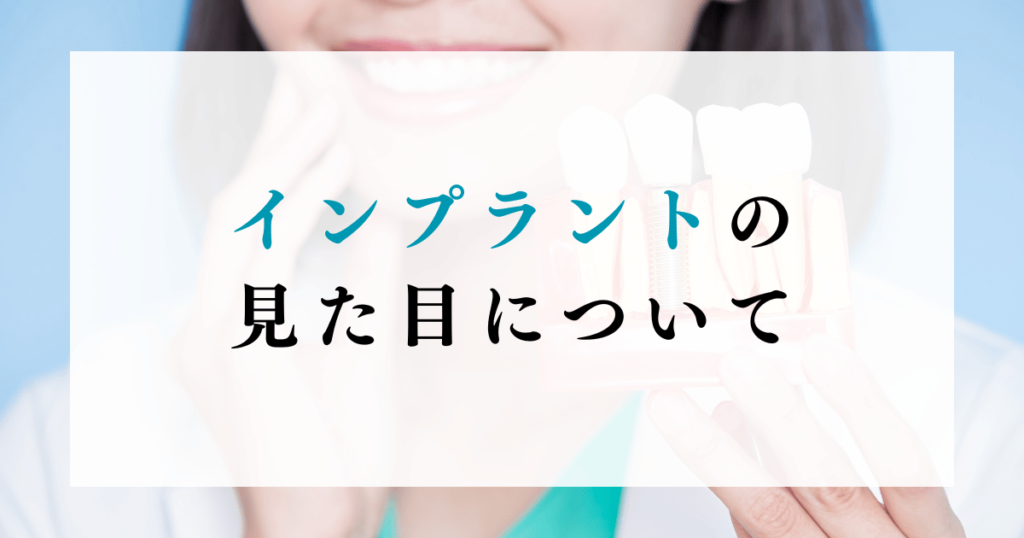 インプラントの見た目について