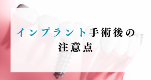 インプラント手術後の注意点