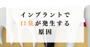 インプラントで口臭が発生する原因