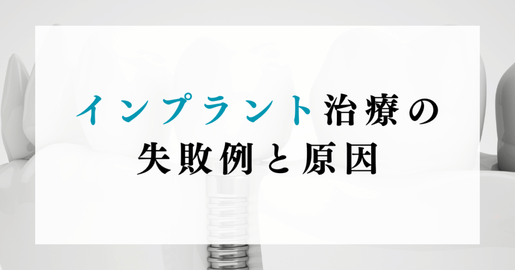 インプラント治療の失敗例と原因