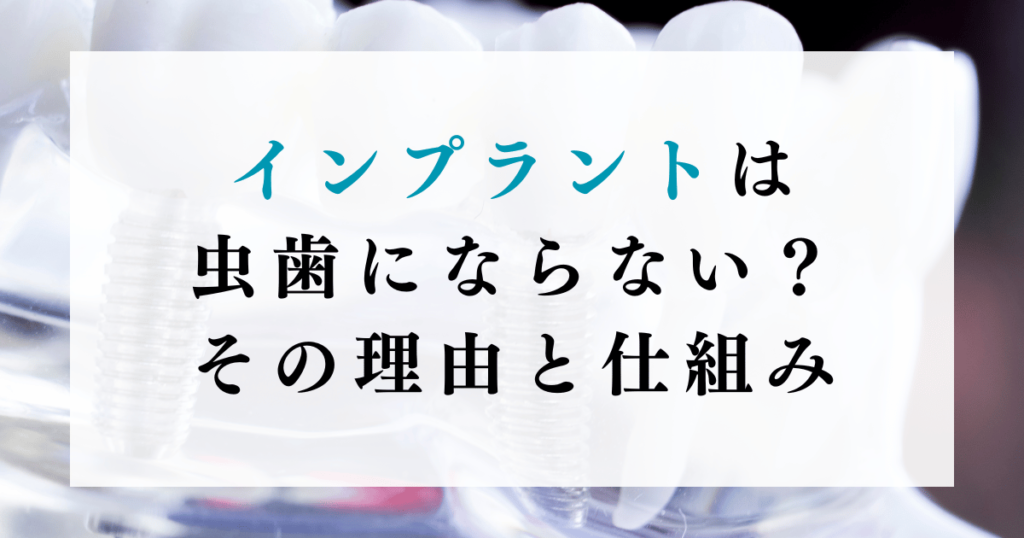 インプラントは虫歯にならない？その理由と仕組み