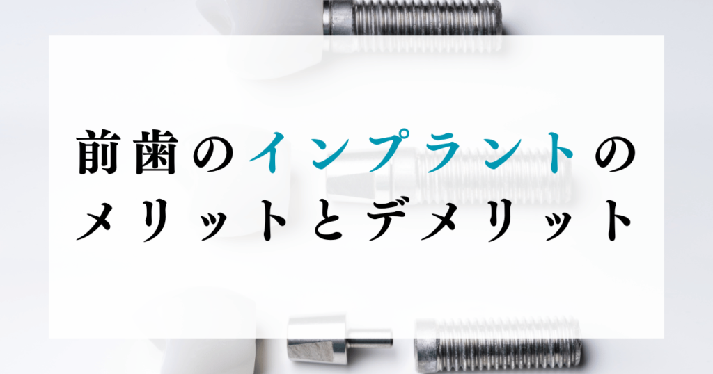 前歯のインプラントのメリットとデメリット