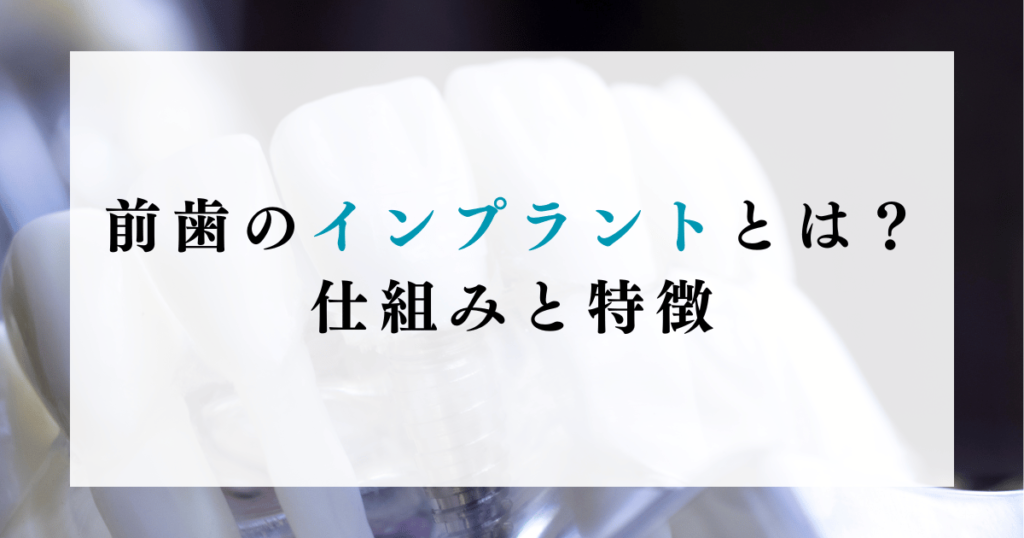 前歯のインプラントとは？仕組みと特徴