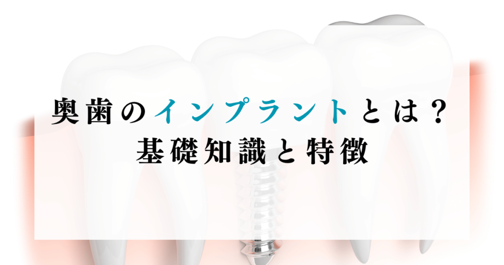 奥歯のインプラントとは？基礎知識と特徴