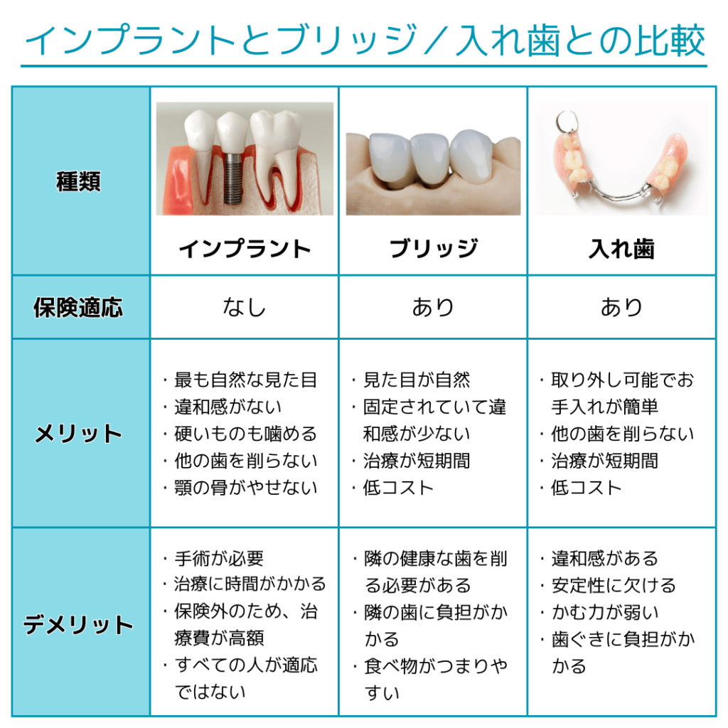 インプラントとブリッジ、入れ歯との比較