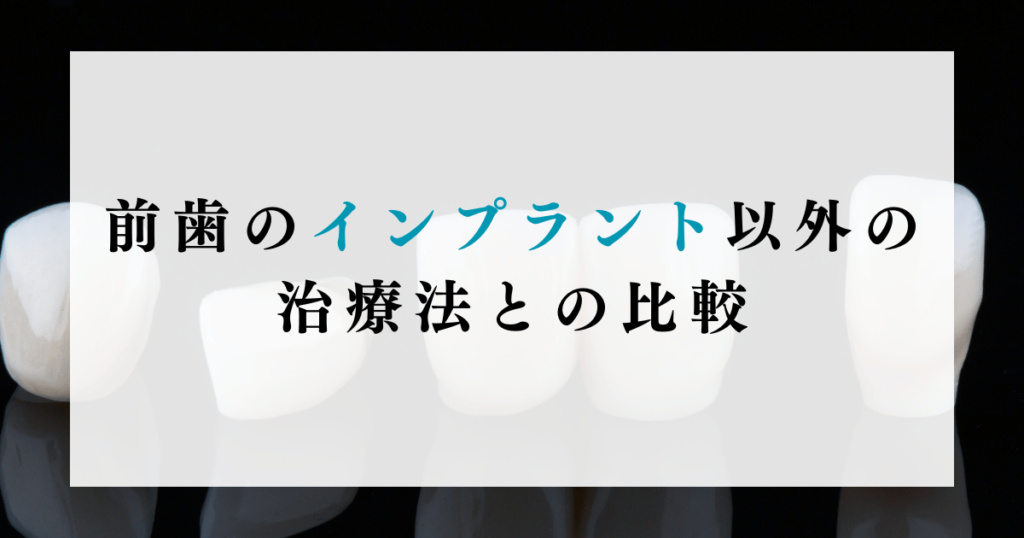 前歯のインプラント以外の治療法との比較