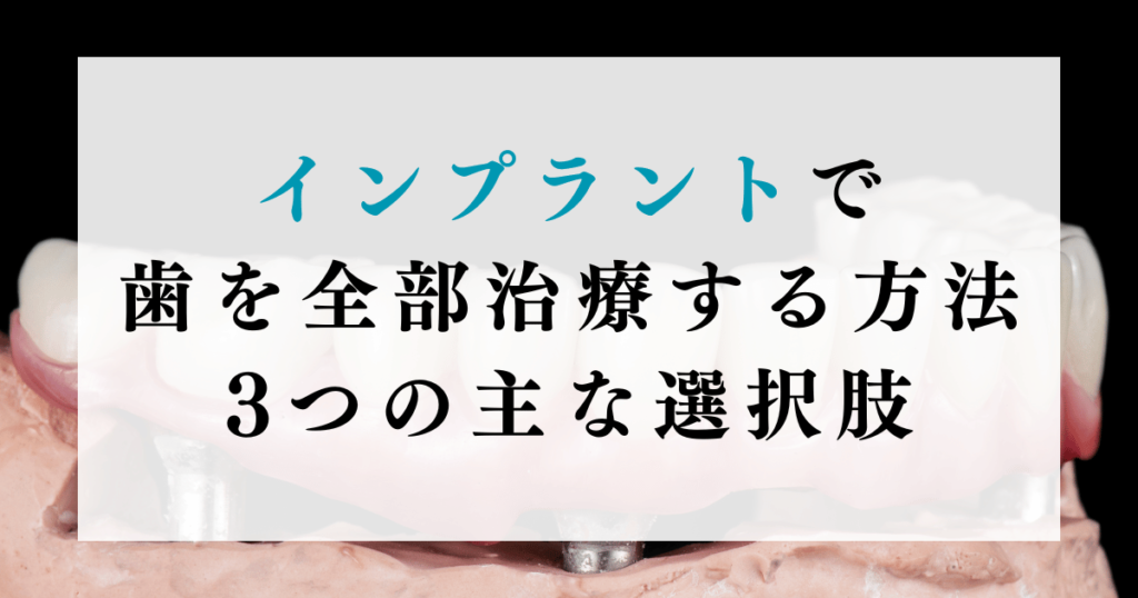 インプラントで歯を全部治療する方法：3つの主な選択肢