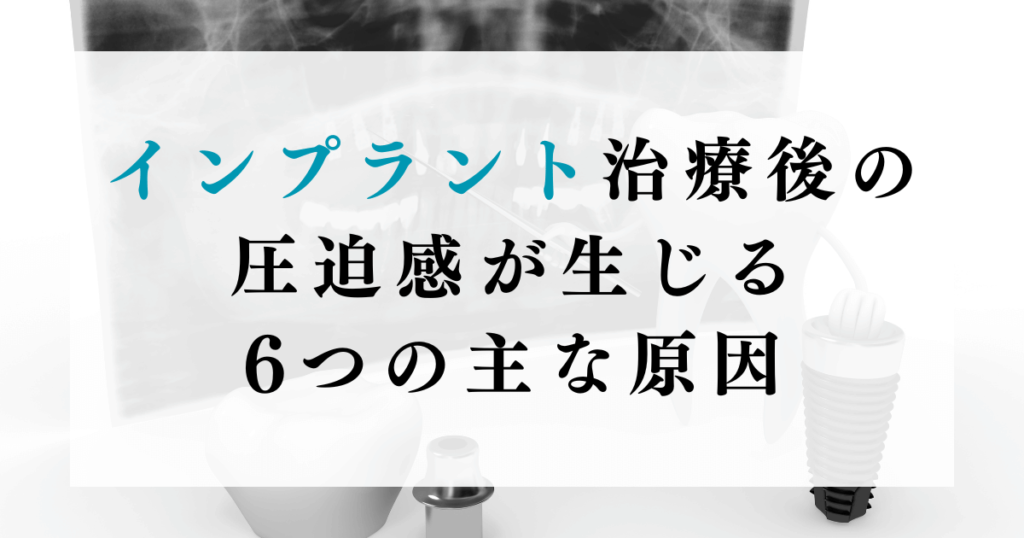 インプラント治療後の圧迫感が生じる6つの主な原因