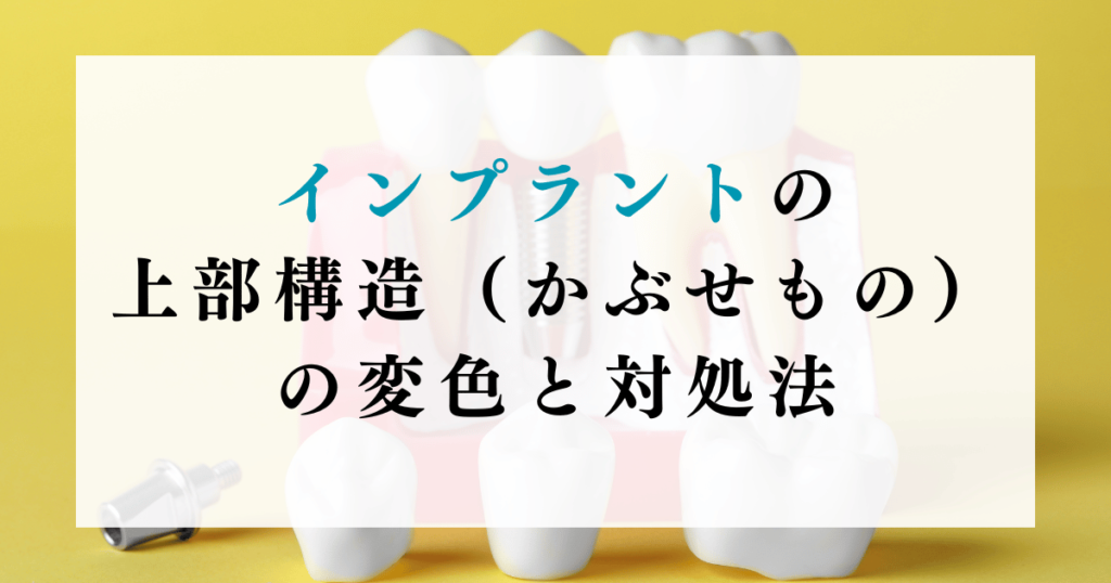 インプラントの上部構造（かぶせもの）の変色と対処法