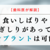 【歯科医が解説】食いしばりや歯ぎしりがあってもインプラントは可能？