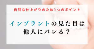 インプラントの見た目は他人にバレる？｜自然な仕上がりのため5つのポイント