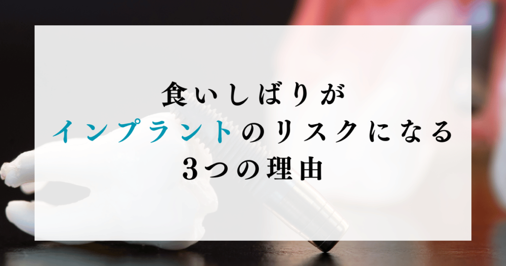 食いしばりがインプラントのリスクになる3つの理由