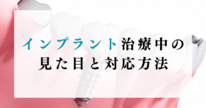 インプラント治療中の見た目と対応方法