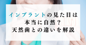 インプラントの見た目は本当に自然？天然歯との違いを解説