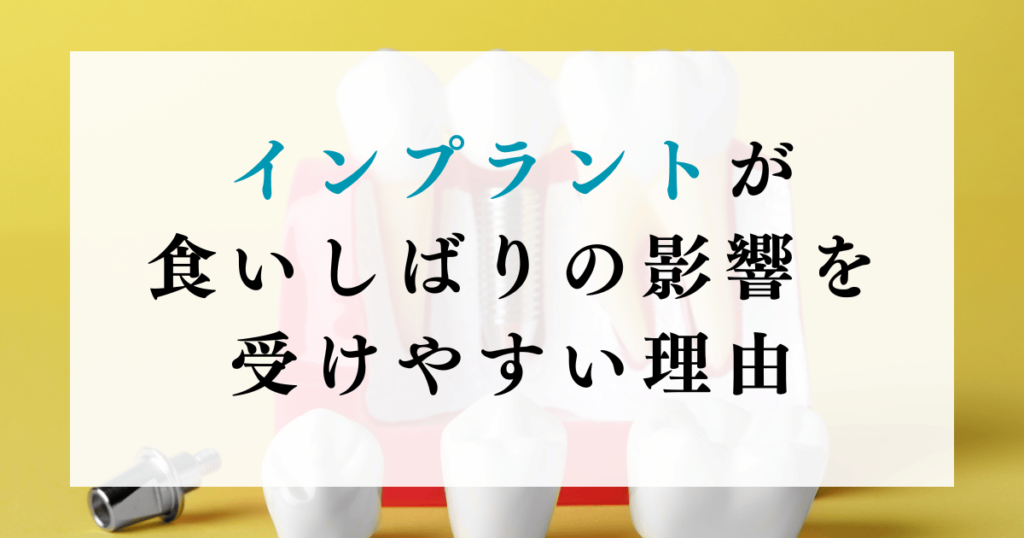 インプラントが食いしばりの影響を受けやすい理由