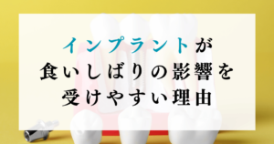 インプラントが食いしばりの影響を受けやすい理由